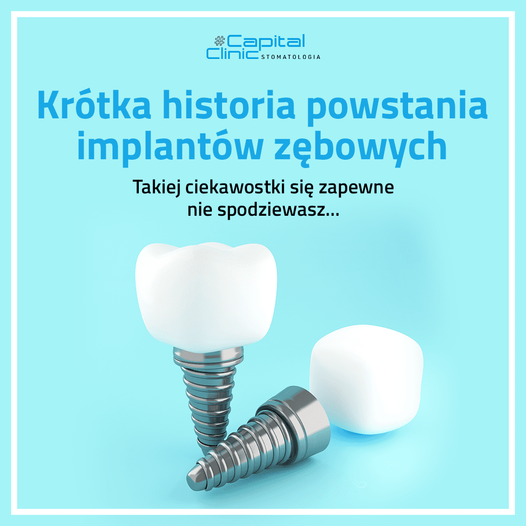 Krótka historia implantów zębowych