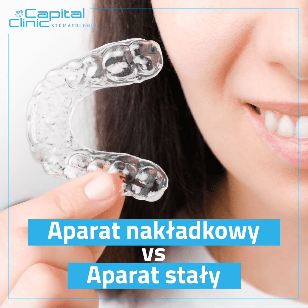 Nakładki czy tradycyjny aparat ortodontyczny?