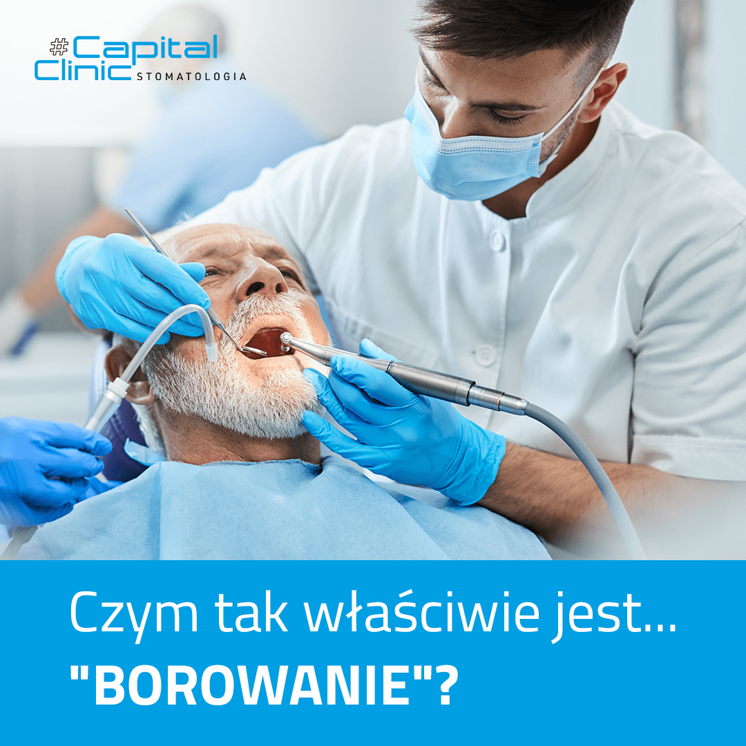 Czym tak właściwie jest "borowanie"?