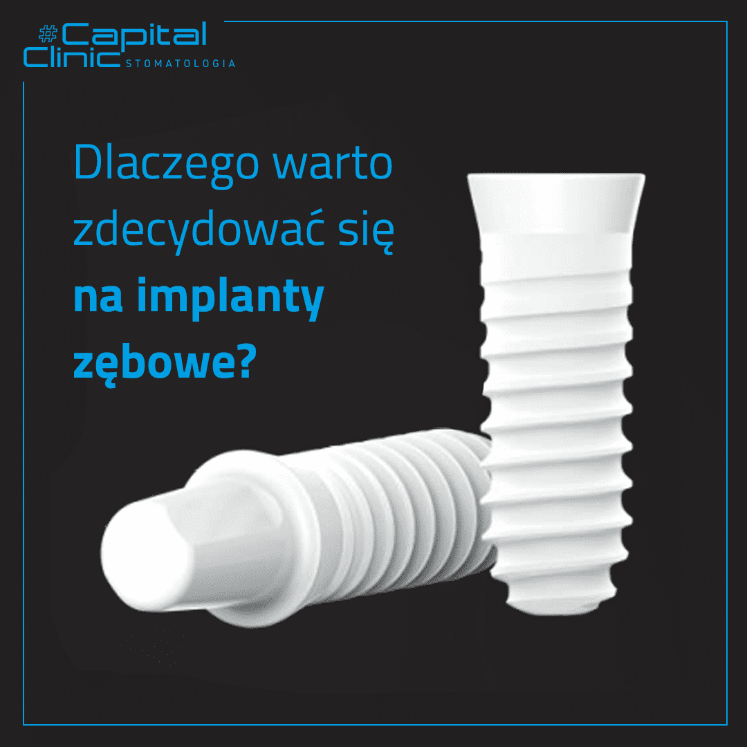 Implanty zębowe.