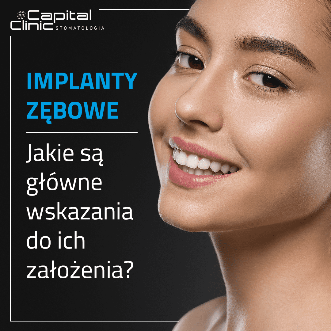 Implanty zębowe