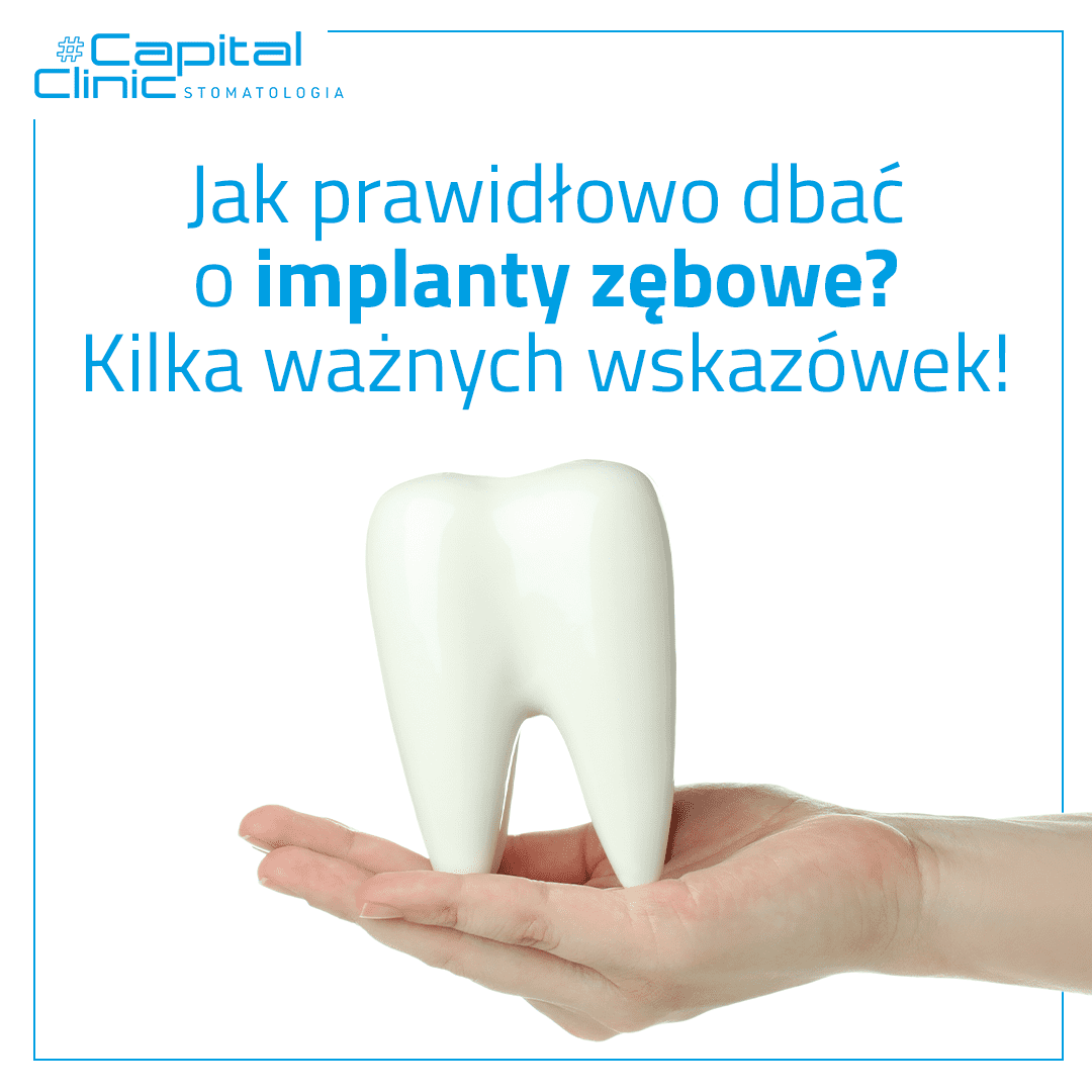 Jak dbać o implanty zębowe?