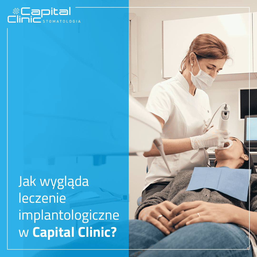 Leczenie implantologiczne