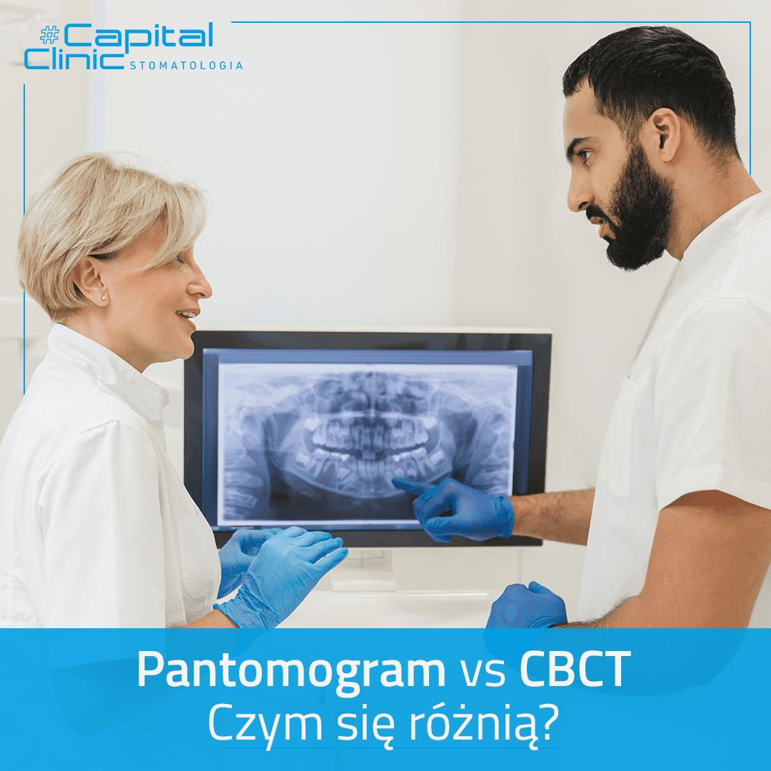Pantomogram czy CBCT?
