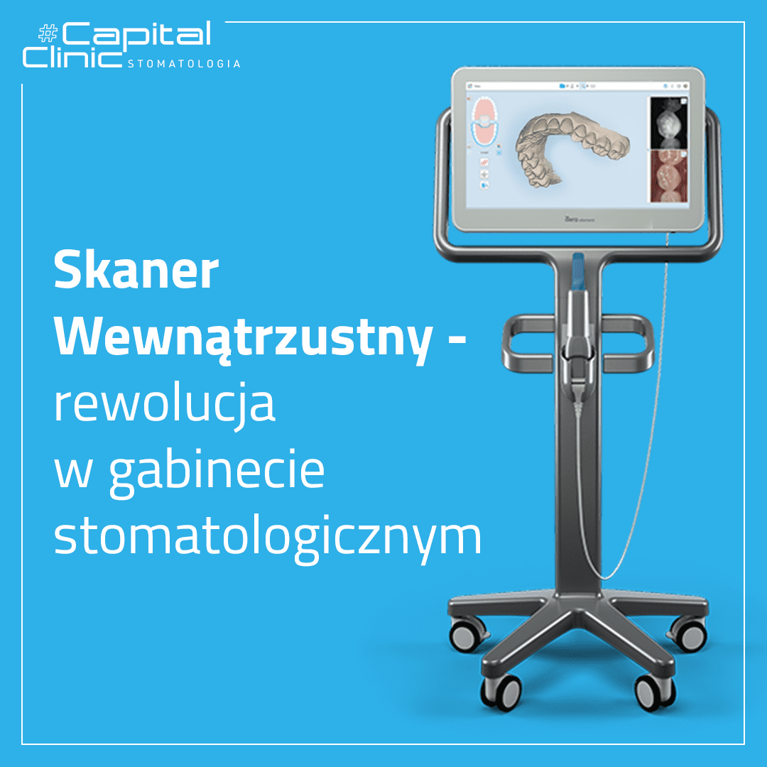 Skaner wewnątrzustny